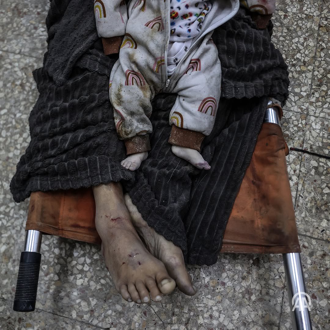 More than 230 Palestinians, including children and women, were killed strikes across Gaza Strip, on March 18, 2025.