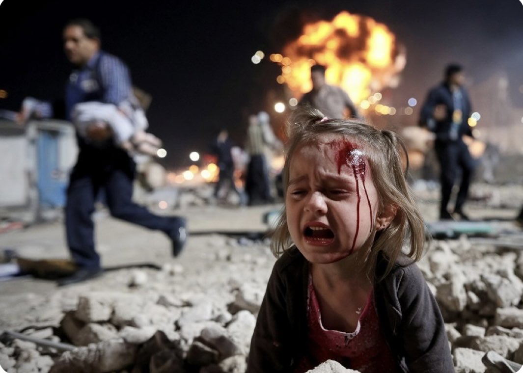 Çocuklar maalesef yalnızca sokaklardaki başıboş vahşi köpeklerce yaralanıp katledilmiyor.Çocuk her yerde çocuktur,her şart altında ve her türlü saldırı karşısında korunup,kollanmalı,sarılıp sarmalanmalı ve çocukluğunu korkusuzca yaşayabilmelidir. Ya Kahhar, Ya Kahhar, Ya Kahhar.