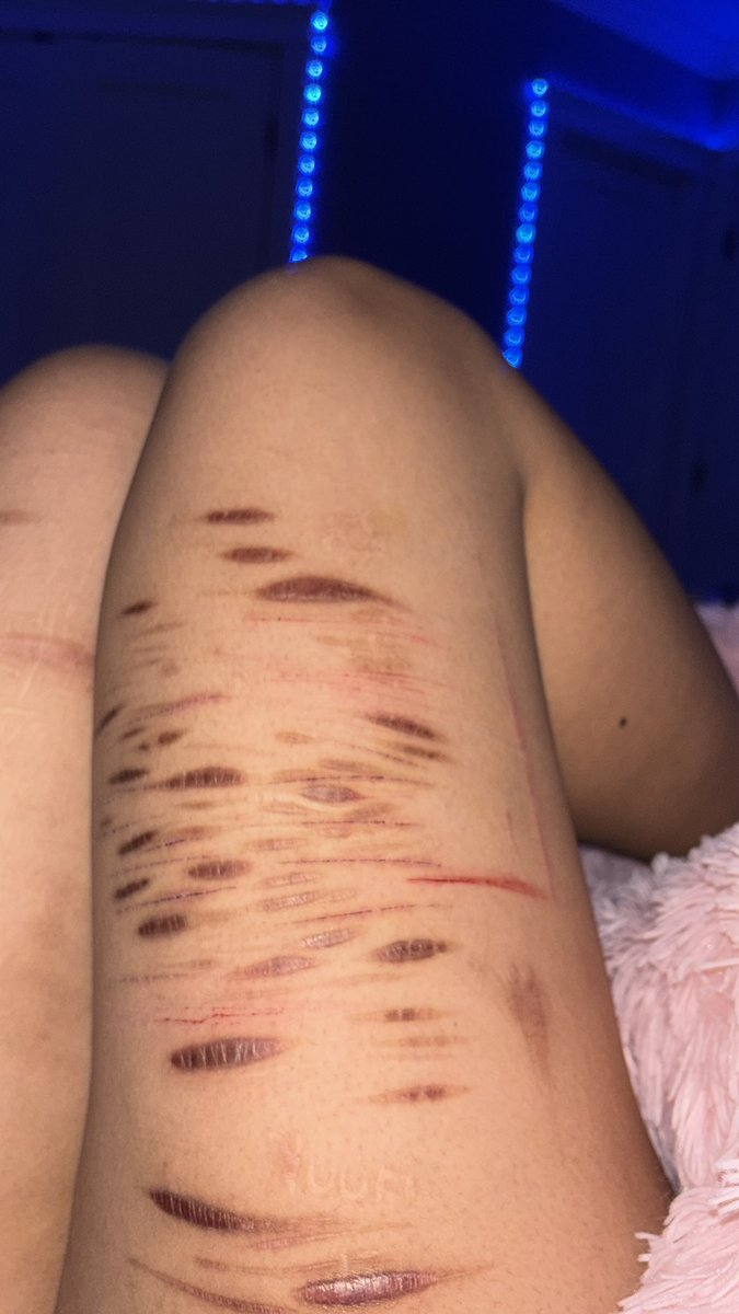 m_3m33's tweet photo. fat thighs I hate them and my dull ass blades 
Shtwt shedtwt https://t.co/CedeORn7FK