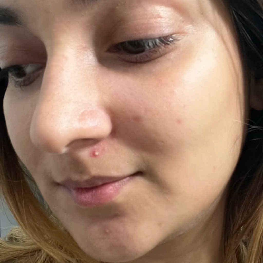 _zhraxs's tweet image. Babe, if you ada tepung beras &amp;amp; madu please do yourself a favor, buat rice face mask, consistent &amp;amp; tengok your skin brighten up in a week!✨

and there’s a reason why this hack is viral in every nation, because it works!!