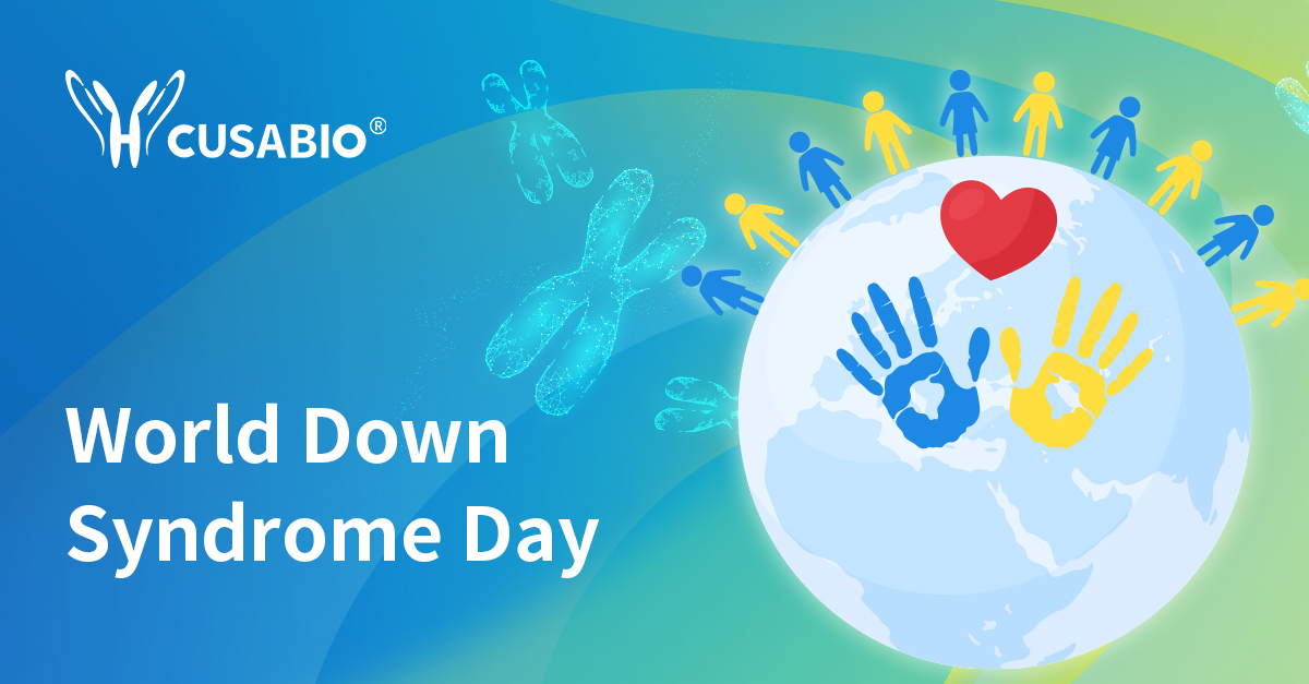 cusabio_mt's tweet image. Down Syndrome (DS), or trisomy 21, is a common chromosomal condition linked to developmental delays, intellectual disabilities, and various health challenges. While DS was misunderstood for centuries, modern research has revealed its distinct nature, separate from thyroid…