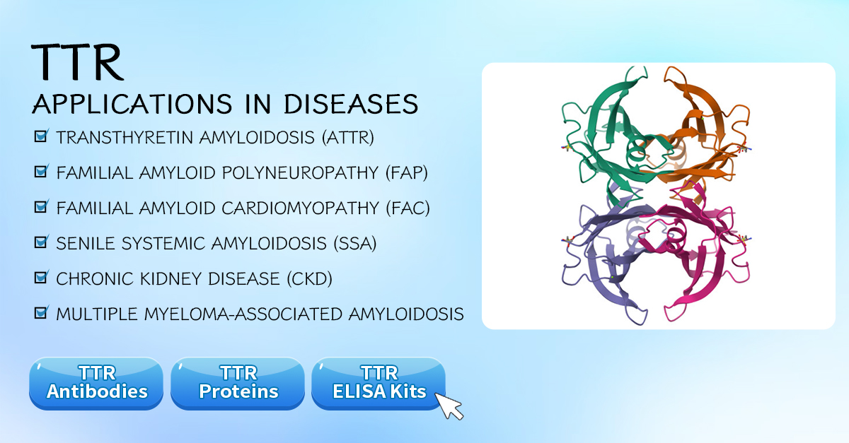 cusabio_mt's tweet image. #Transthyretin (#TTR) transports thyroid hormones (T4/T3) and vitamin A, ensuring proper metabolic regulation, growth, and visual function. When misfolded, TTR forms amyloid aggregates, the main pathological feature of hereditary transthyretin #amyloidosis (#hATTR), leading to…