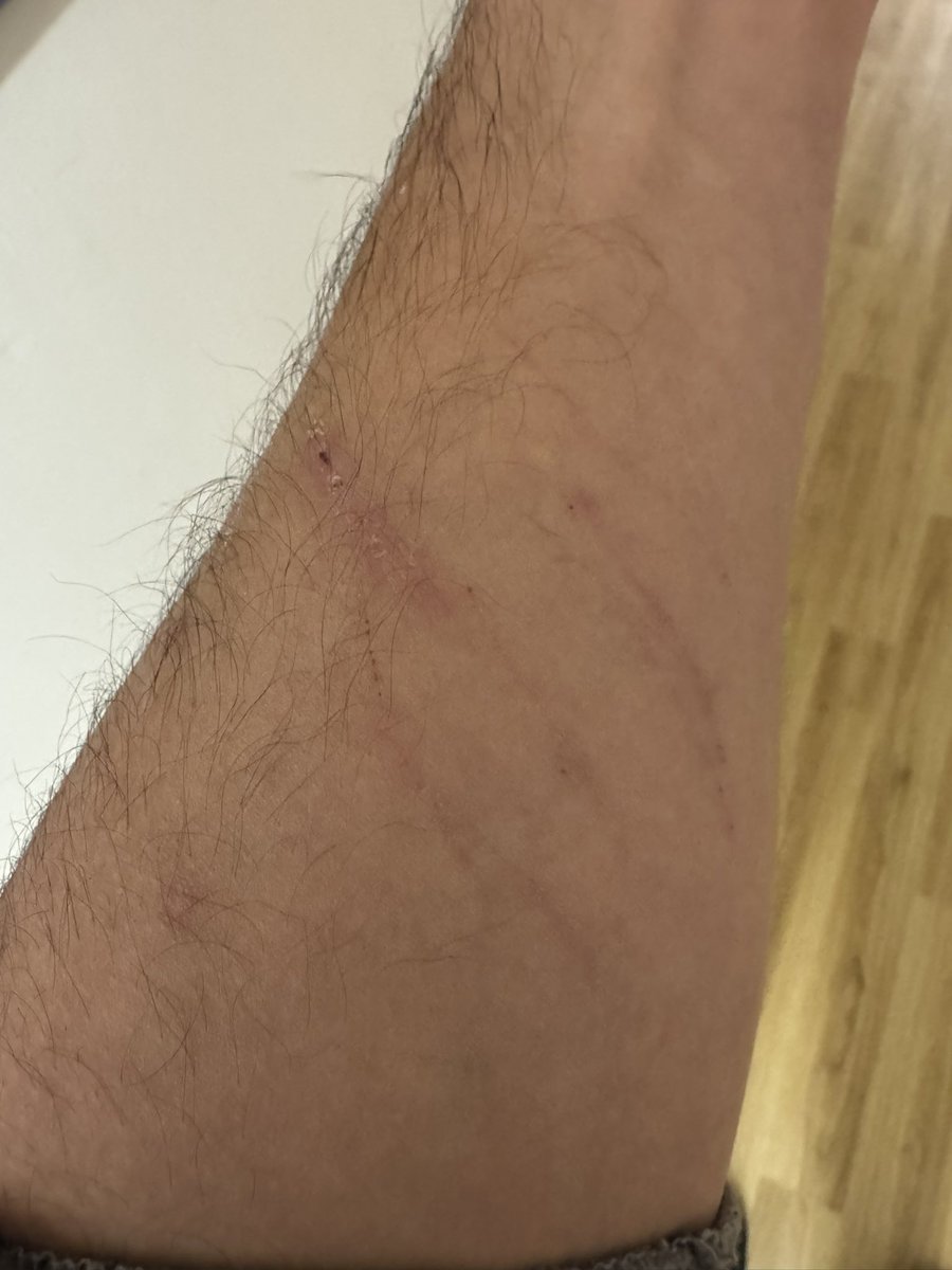 jkamecki's tweet photo. @TuckerCarlson I’ve recently been attacked by demons while asleep too https://t.co/bixKUs686E