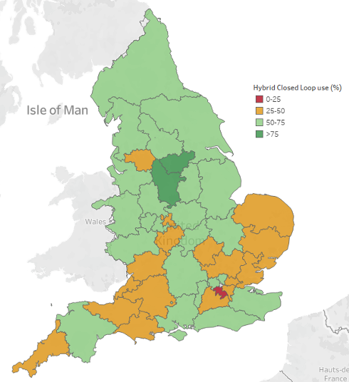 parthaskar's tweet image. #HybridClosedLoop uptake

Ages: 0-18 with #T1Diabetes 

Implementation of @NICEComms TA 943 -released Dec 2023

Data from @NPDA_RCPCH till end December 2024

The 'Map' at 12 months

Yeah, baby, the maps are back.

The mission? Exactly the same as with #CGM 

Dark-Green everywhere