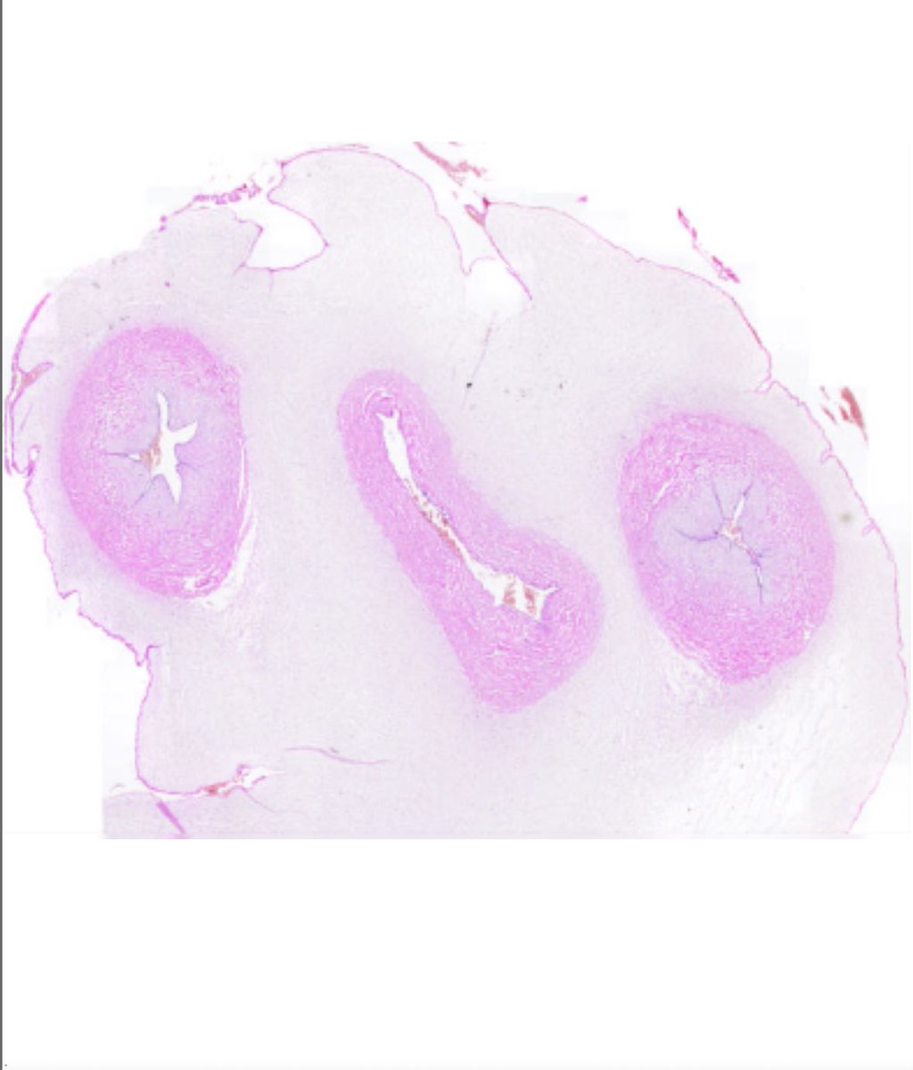microscopio_v's tweet image. Sonrían! Llegó el cordón umbilical al microscopio virtual
microscopiovirtual.fmed.edu.uy/c_ap_placenta_…