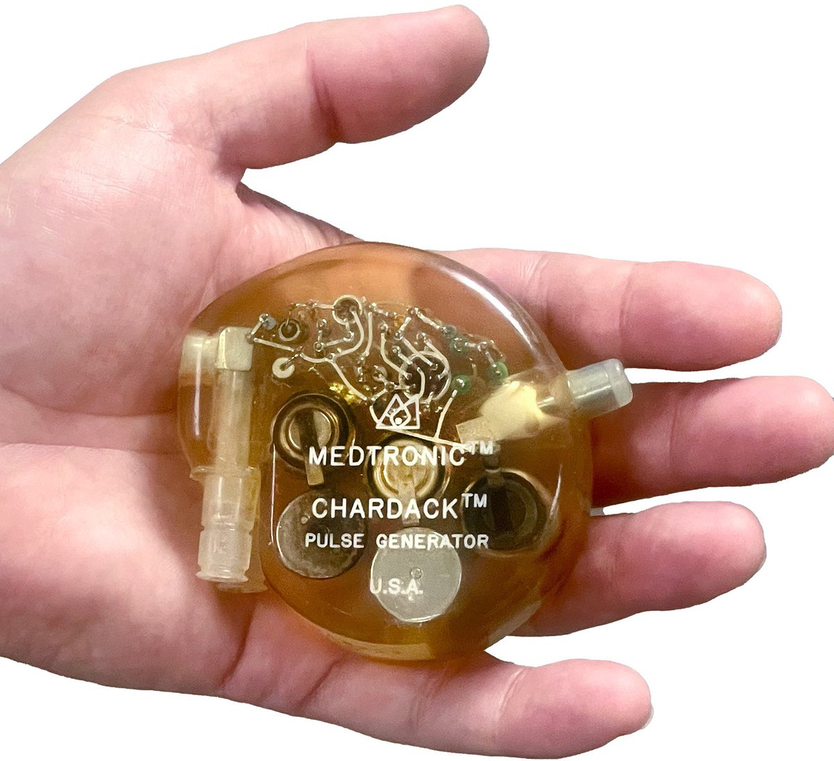 Heart Rhythm Case Reports (@hrs_casereports) on Twitter photo Sixty Years of Continuous Pacemaker-Dependency
<a href="/ShockDocOK/">David Sandler</a>
heartrhythmcasereports.com/article/S2214-… Sixty Years of Continuous Pacemaker-Dependency
<a href="/ShockDocOK/">David Sandler</a>
heartrhythmcasereports.com/article/S2214-…