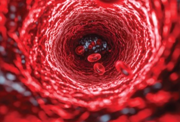 The fifth edition of guidelines on the use of regional anesthesia in patients receiving direct oral anticoagulants or antiplatelet medications. 

 painmedicinenews.com/a/8CoBAA/t