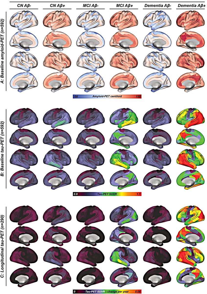Molecular Neurodegeneration (@molneuro) on Twitter photo 'Alpha #synuclein co-pathology is associated with accelerated #amyloid-driven tau accumulation in #AlzheimersDisease'
Nicolai Franzmeier <a href="/nfranzme/">Nico Franzmeier</a> <a href="/SebRoemer/">Sebastian Roemer-Cassiano</a> Alexander Maximilian Bernhardt...<a href="/johanneslevin/">Johannes Levin</a> <a href="/matbrendel/">MatthiasBrendel</a> Günter U. Höglinger <a href="/LMU_Muenchen/">Universität München</a>
bit.ly/4bCVh0H 'Alpha #synuclein co-pathology is associated with accelerated #amyloid-driven tau accumulation in #AlzheimersDisease'
Nicolai Franzmeier <a href="/nfranzme/">Nico Franzmeier</a> <a href="/SebRoemer/">Sebastian Roemer-Cassiano</a> Alexander Maximilian Bernhardt...<a href="/johanneslevin/">Johannes Levin</a> <a href="/matbrendel/">MatthiasBrendel</a> Günter U. Höglinger <a href="/LMU_Muenchen/">Universität München</a>
bit.ly/4bCVh0H