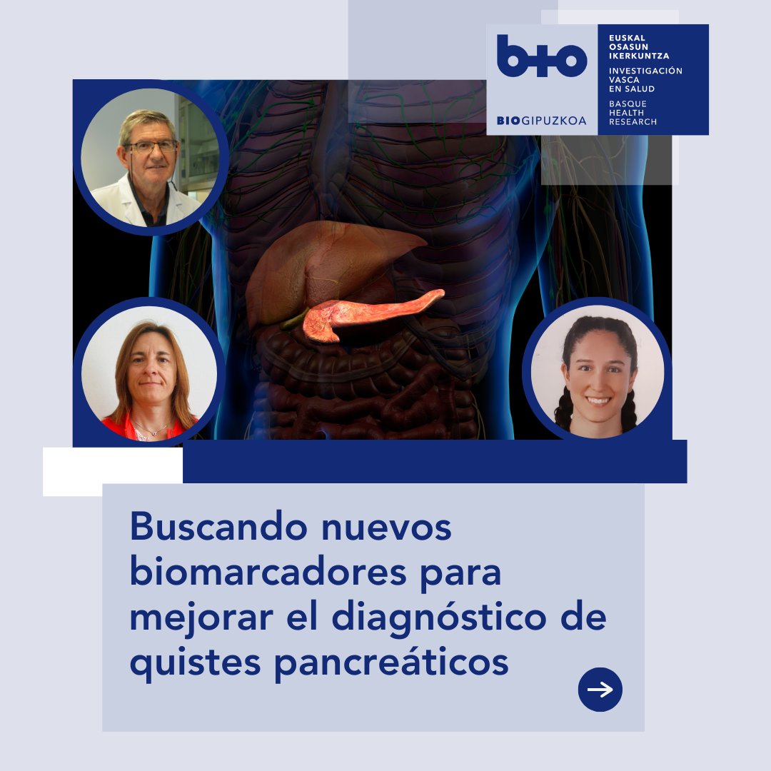 biogipuzkoa's tweet photo. 🔎 Buscando nuevos biomarcadores para mejorar el diagnóstico de quistes pancreáticos

📝 https://t.co/vSv2dzy6dg

🔗 https://t.co/E5hFHlBpEf

#Biogipuzkoa https://t.co/EXCLSE1aOZ