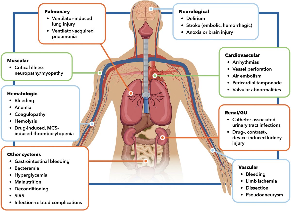 Shashank Sinha, MD, MSc, FACC, FAHA, FHFSA (@shashanksinhamd) on Twitter photo Honored to chair & lead 1st <a href="/ACCinTouch/">American College of Cardiology</a> Concise Clinical Guidance on #CardiogenicShock designed to help clinicians across ALL hospitals to SUSPECT & manage CS Many🙏#DrDavidMorrow <a href="/NavinKapur4/">Navin Kapur</a> <a href="/rachkataria/">Rachna Kataria, MD</a> <a href="/DrRobRoswell/">Robert Roswell</a> for collaboration! <a href="/JACCJournals/">JACC Journals</a> <a href="/ISHVnews/">Inova Schar Heart and Vascular</a> <a href="/InovaHealth/">Inova</a> Honored to chair & lead 1st <a href="/ACCinTouch/">American College of Cardiology</a> Concise Clinical Guidance on #CardiogenicShock designed to help clinicians across ALL hospitals to SUSPECT & manage CS Many🙏#DrDavidMorrow <a href="/NavinKapur4/">Navin Kapur</a> <a href="/rachkataria/">Rachna Kataria, MD</a> <a href="/DrRobRoswell/">Robert Roswell</a> for collaboration! <a href="/JACCJournals/">JACC Journals</a> <a href="/ISHVnews/">Inova Schar Heart and Vascular</a> <a href="/InovaHealth/">Inova</a>