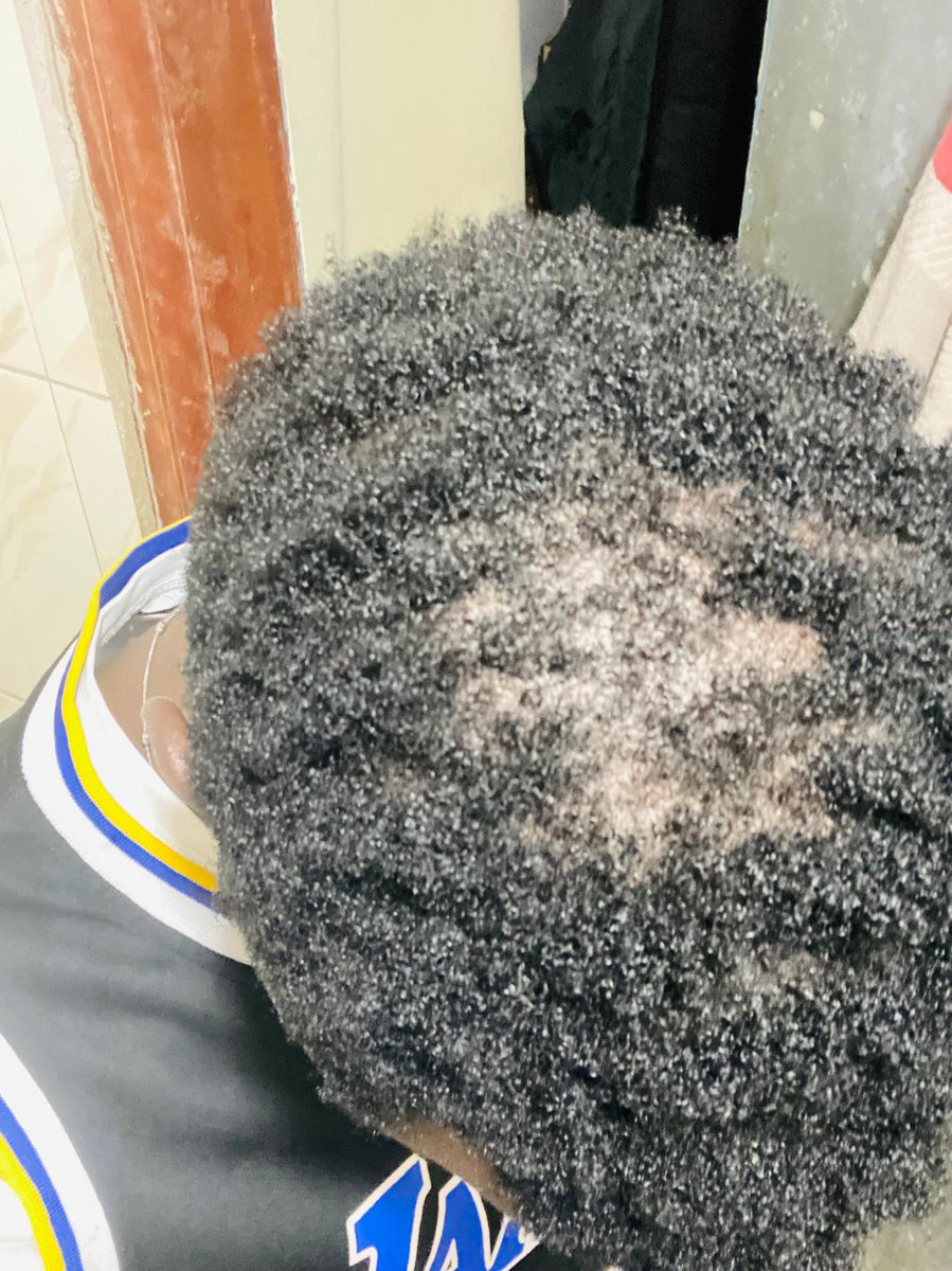 Nakayiza_'s tweet image. The @pzazrionaturals hair recovery pack for hair loss/alopecia reversal at 125K ugx.
This client started on 1st November. He sent in this review today! #hairlosssolution #hairfall #hairfallcontrol 
WhatsApp or call 0701207574 NOW bestie.