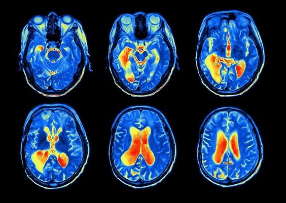 matthew_labosco's tweet photo. I’m 47.

Stress controlled me for years...

I worked 6.5 days a week, barely saw my family, and was drained no matter how much I slept.

After 10,000+ hours of coaching, I uncovered why most stress solutions fail.

Here’s how I retrained my nervous system &amp; took my life back: 🧵 https://t.co/SBJsGUBx87