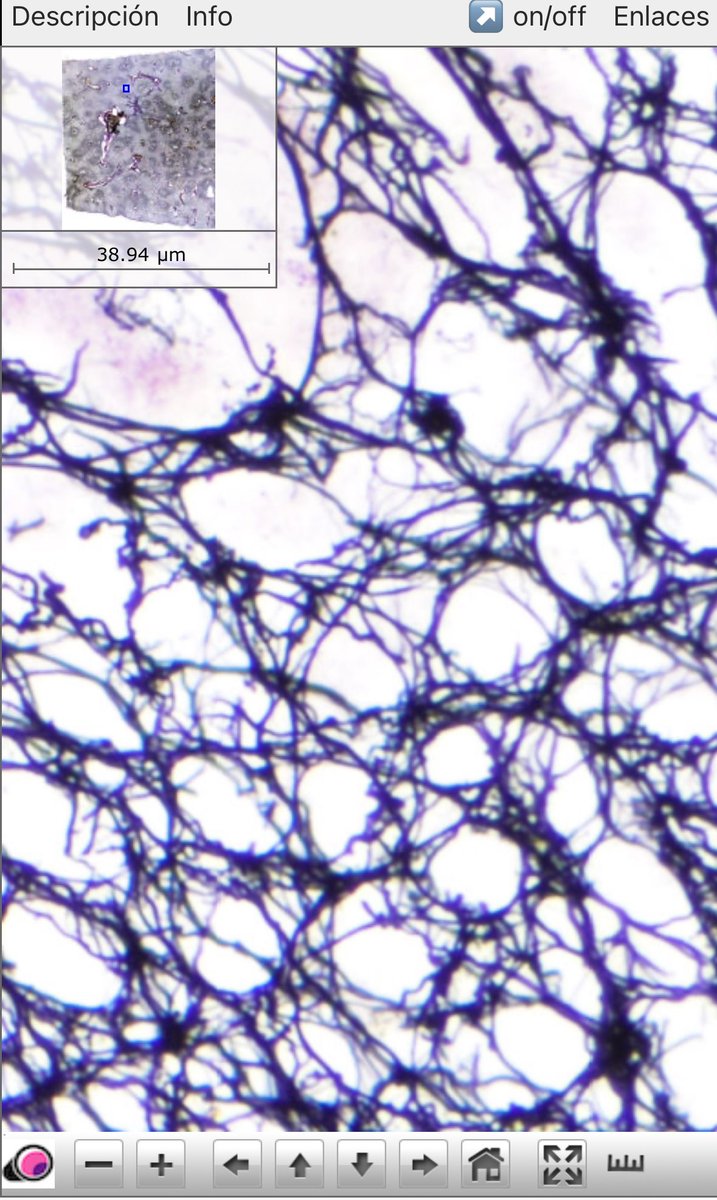 microscopio_v's tweet image. Quieren ver fibras? Acá tenemos un preparado nuevo en el que se ven muy bien las fibras reticulares y fibras de colágeno:
72: hígado - doble impregnación argéntica
microscopiovirtual.fmed.edu.uy/c_t_conjuntivo…