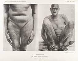 AlanWyman01's tweet photo. #Circumcision in historical and cultural contexts:
#CircumcisionHistory
#AncientEgypt
#HebrewCovenant
#IslamicSlaveTrade
#GrecoRomanCulture
#RedSeaSlaveTrade
#FemaleGenitalCutting
#SlaveryPractices
#ReligiousRituals
#CulturalHistory
👇〽 https://t.co/qkJZmr289Y