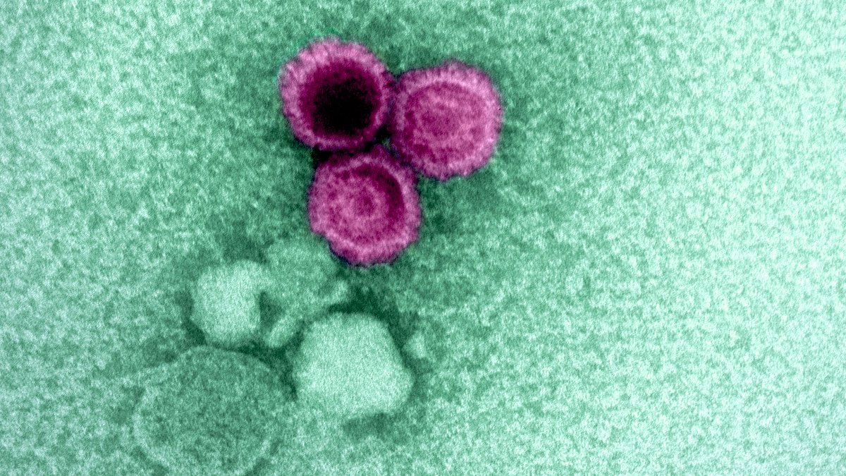 🔬 Un nuevo estudio publicado en @sciencemagazine profundiza en el órgano del cuerpo donde es posible que se origine la #EsclerosisMúltiple.

🦠 Todo apunta a una reactivación del #virus del Epstein-Barr (VEB) como el posible motor de la enfermedad.

💡 Esto puede ser clave a la