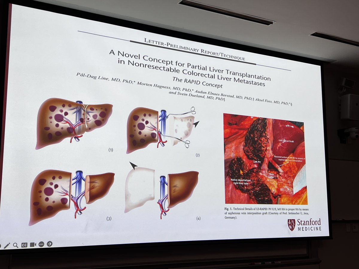 StanfordAbdTxp (@stanfordabdtxp) on Twitter photo 🗣️🎙️ Great start to the morning, Dr. <a href="/KazuS123456789s/">Kazu Sasaki</a> delivered an insightful lecture on Transplant Oncology at <a href="/StanfordSurgery/">Stanford Surgery</a> Grand Rounds. 🗣️🎙️ Great start to the morning, Dr. <a href="/KazuS123456789s/">Kazu Sasaki</a> delivered an insightful lecture on Transplant Oncology at <a href="/StanfordSurgery/">Stanford Surgery</a> Grand Rounds.