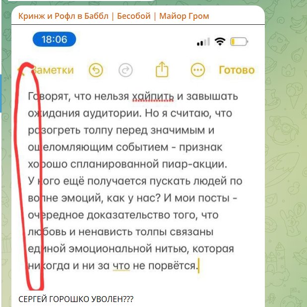 lovernofriend's tweet photo. СУКААААААААА https://t.co/XeHozoYR4E