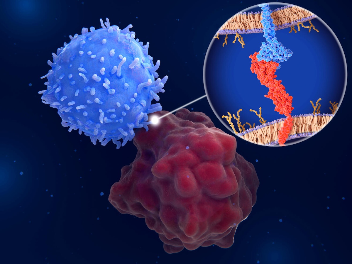 Mayo Clinic ENT (@mayoclinicent) on Twitter photo What are the outcomes of immunotherapy in sinonasal mucosal melanoma?
Click to read more: bit.ly/42c8oTj
#MayoClinicENTResearch #MedTwitter <a href="/rijulkmd/">Rijul Kshirsagar, MD</a> #JacobEide #JacobHarris #ArashAbiri #DanielBeswick #EugeneChang #NicholasFung #MichelleHong #BrianJohnson What are the outcomes of immunotherapy in sinonasal mucosal melanoma?
Click to read more: bit.ly/42c8oTj
#MayoClinicENTResearch #MedTwitter <a href="/rijulkmd/">Rijul Kshirsagar, MD</a> #JacobEide #JacobHarris #ArashAbiri #DanielBeswick #EugeneChang #NicholasFung #MichelleHong #BrianJohnson