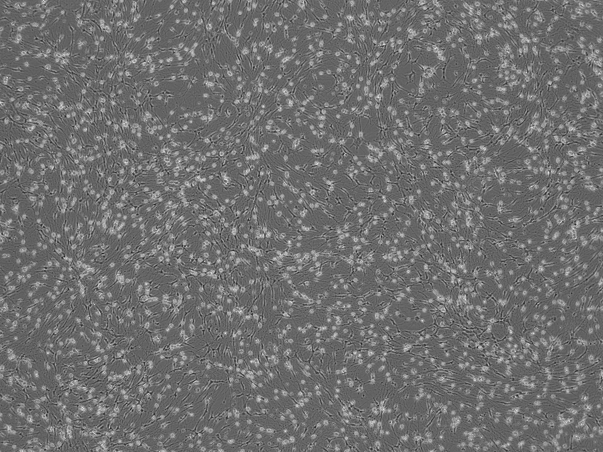 AnatomicTech's tweet image. 💎Check-out the purity💎 Images of co-cultures of RealSCP, hiPSC-derived Schwann cell precursors, and RealDRG, hiPSC-derived sensory neurons, generated without the need for genetic engineering or Mitomycin C

#CompleteTheCircuit #NotYourAverageNeuron