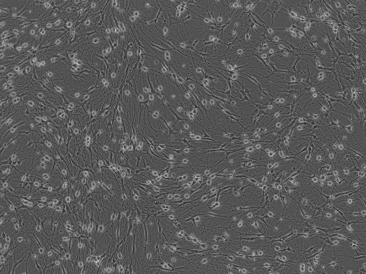 AnatomicTech's tweet image. 💎Check-out the purity💎 Images of co-cultures of RealSCP, hiPSC-derived Schwann cell precursors, and RealDRG, hiPSC-derived sensory neurons, generated without the need for genetic engineering or Mitomycin C

#CompleteTheCircuit #NotYourAverageNeuron