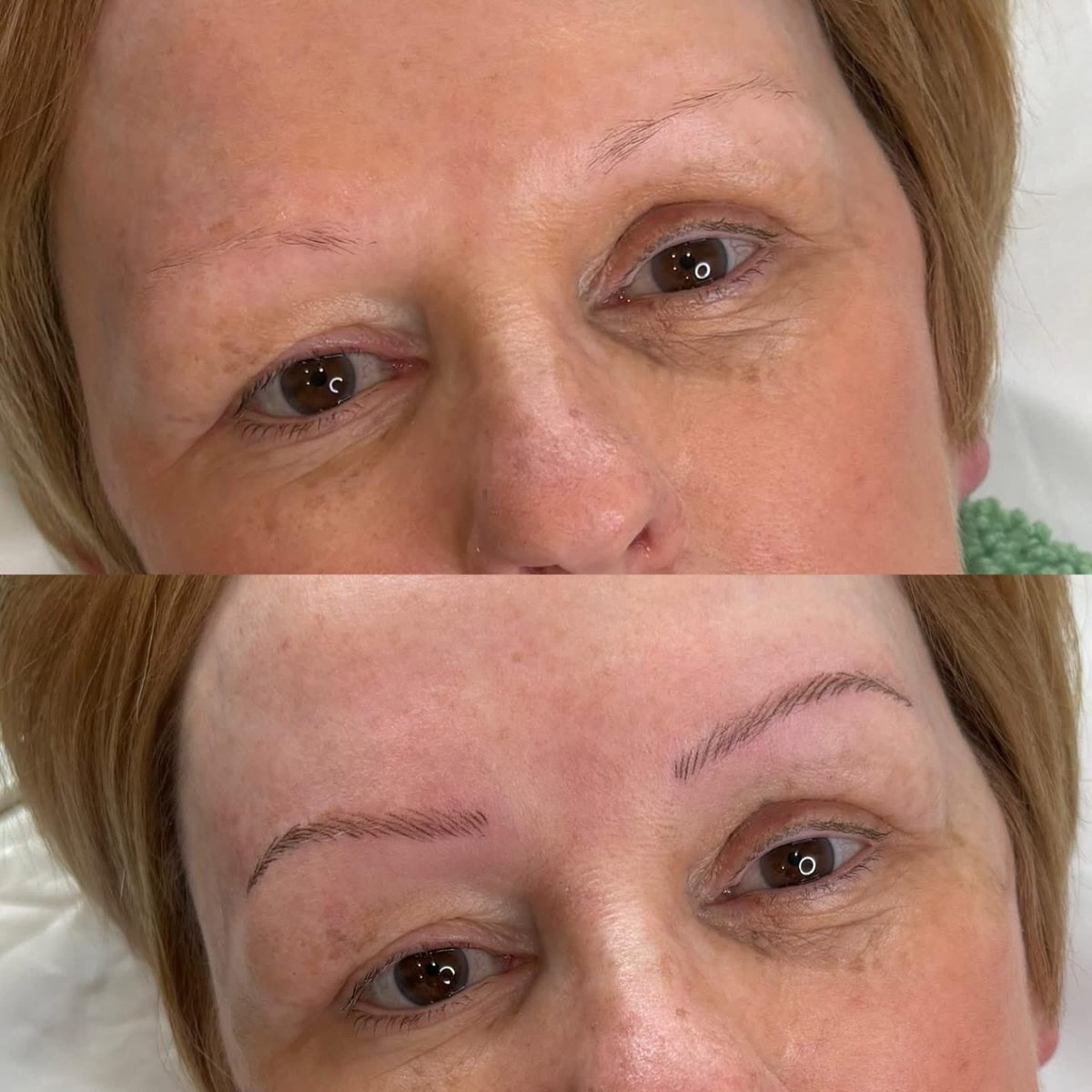 vixmccarthy43's tweet image. Chemically induced menopause and ongoing cancer treatment saw my brows disappear 🫠 so I’ve had nano brows 🥰 
#cancer #brows