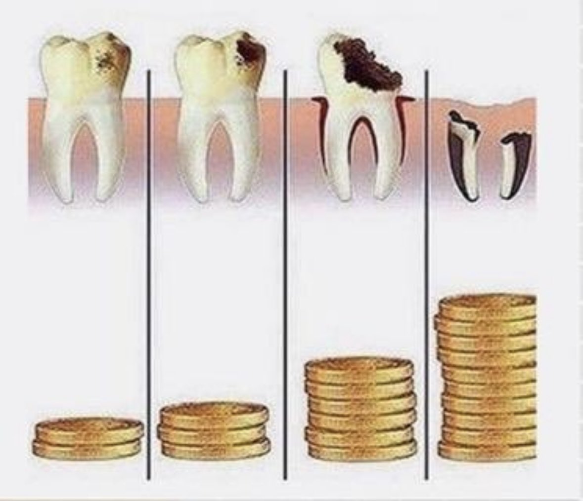 علاقة اهمال العلاج والتكلفة طردية، لذلك يجب الإهتمام بالفحص الدوري والحرص على العلاج المبكر.
 #ڤيو_كلينك