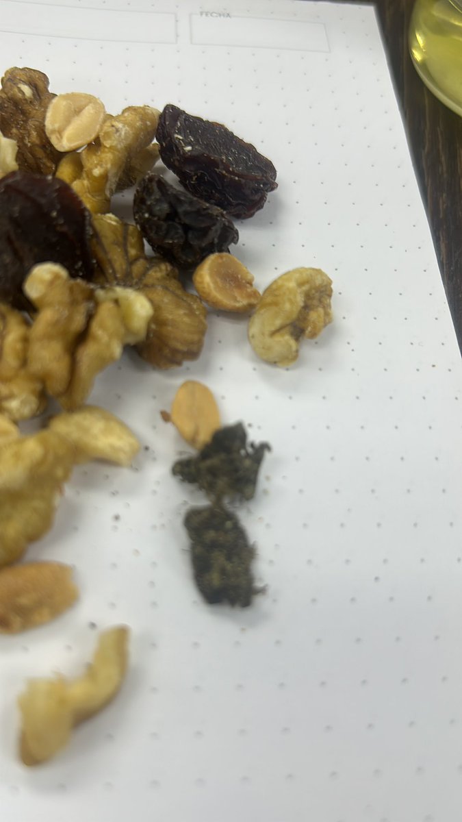 mafermorenod's tweet photo. Buscando un snack saludable encontré esta bolsa de frutos secos en el TuTi en la calle Luque , qué porquería será eso negro que contiene @Arcsa_Ec espero que actúen de forma inmediata https://t.co/PZUFUdJ3hX