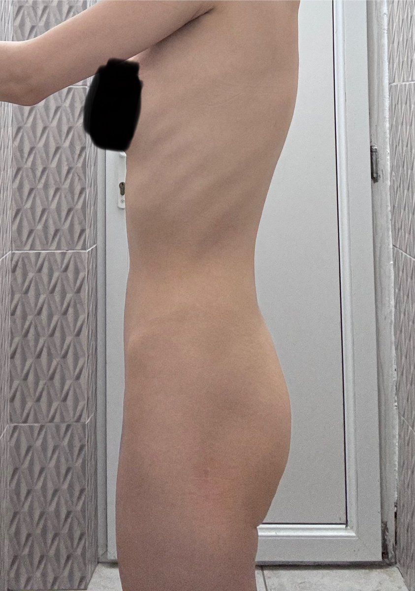 bulimic4ever's tweet photo. 18/03/2025 #edtwt #edtwtᅠ #edtwtthread #fatt #fatgirl #weighin #edtok #mia #miatwt #ana #anatwt #ricecake #ricecaketwt #bodycheck #fatspo #fat #motivation #meanspo #thin #bmi #timeofmonth https://t.co/Fa1CE6rPNP