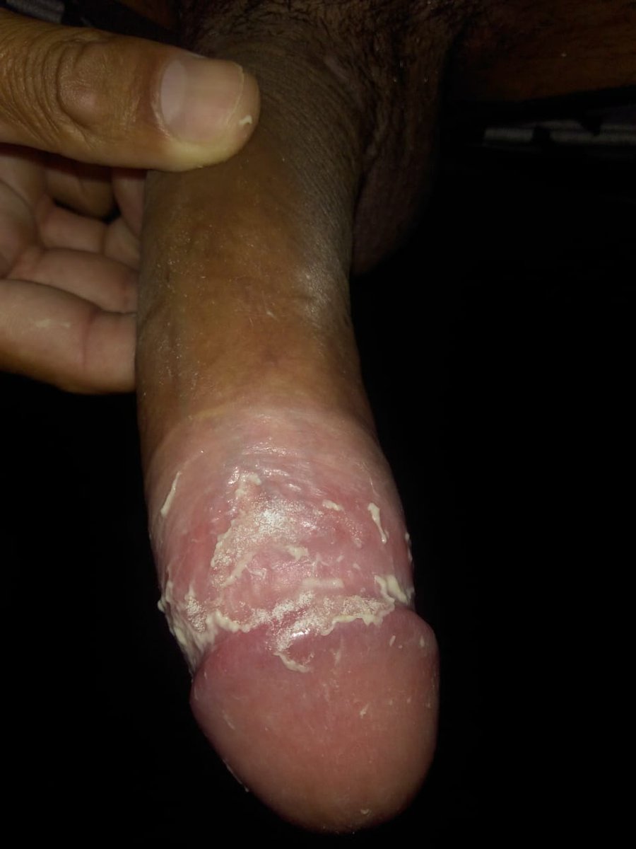 Black Pig Sampa tweet media