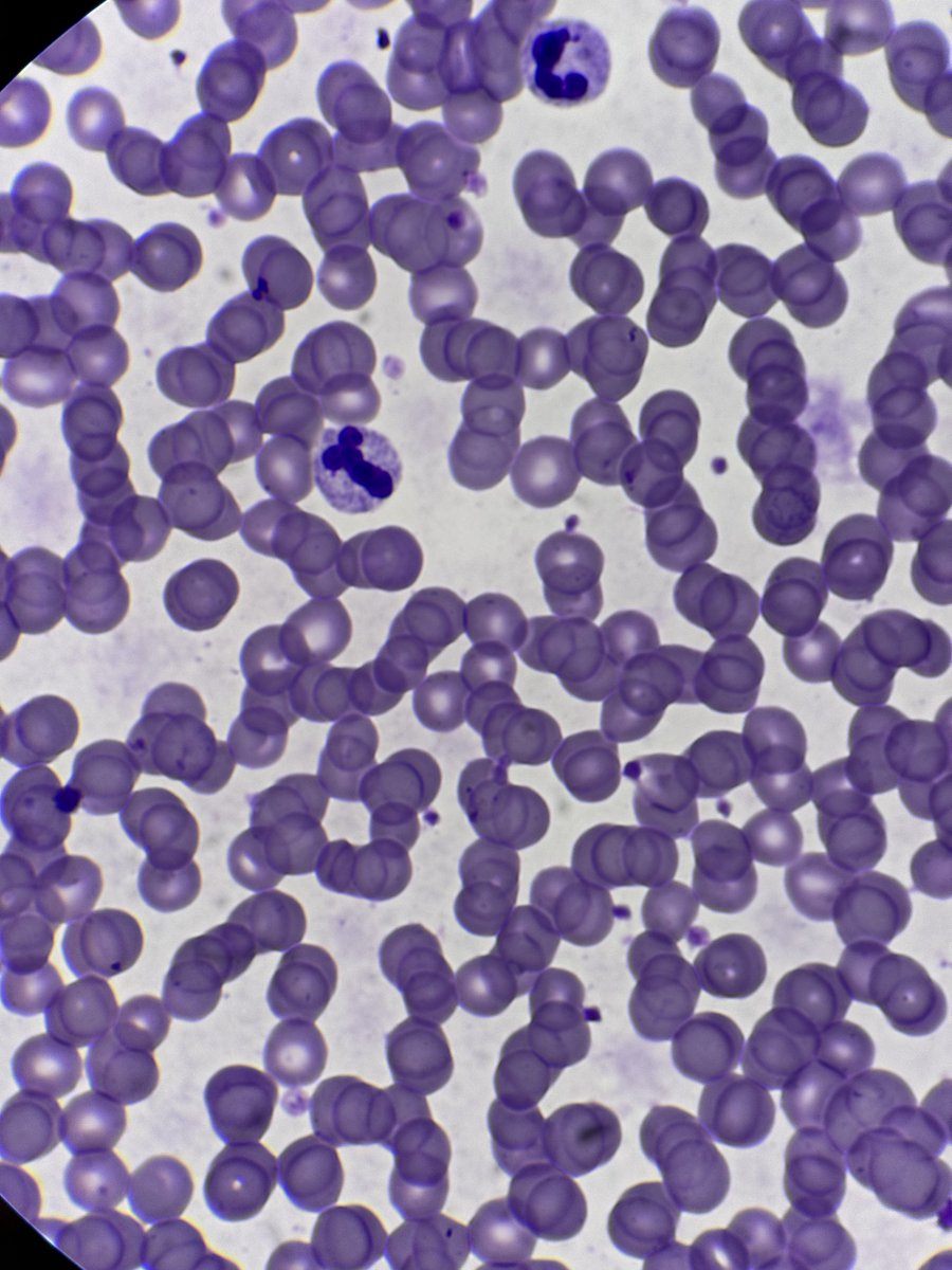 Dildocyte