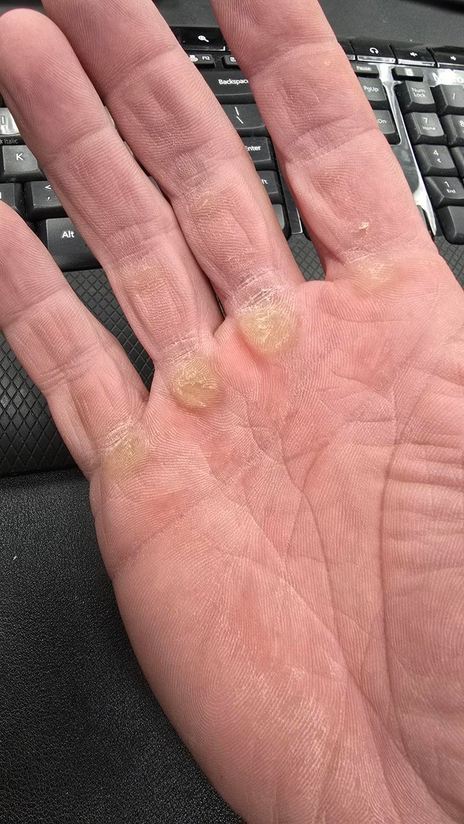 denimphysique's tweet photo. @barbarianfitco You have some catching up to do!!  LOL https://t.co/8z2fvKdArZ