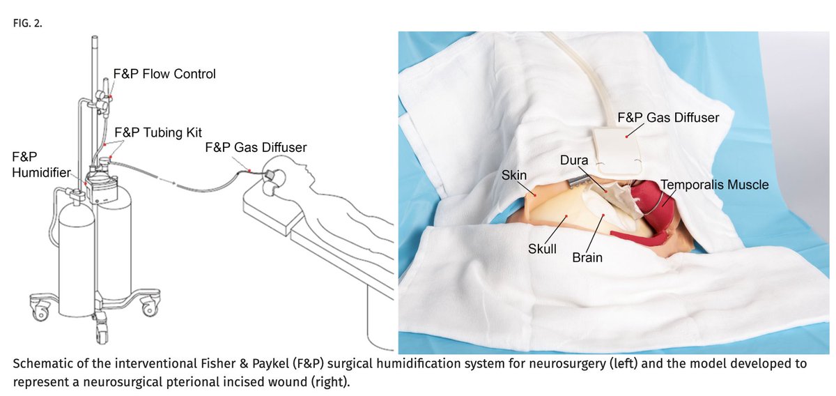 Intraoperative surgical humidification with CO2. Neat. 
thejns.org/caselessons/ca…