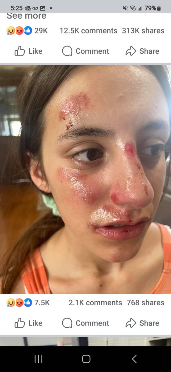 CoffindafferFBI's tweet photo. The face of being bullied. 

And schools do nothing!

Another one of my friend's son killed himself after being mercilessly bullied. 

Please share for awareness. 

Please pressure schools to permanently expel bullies. 

They have No place in schools. Let the parents deal with them. It's not safe for others. 

#bullying