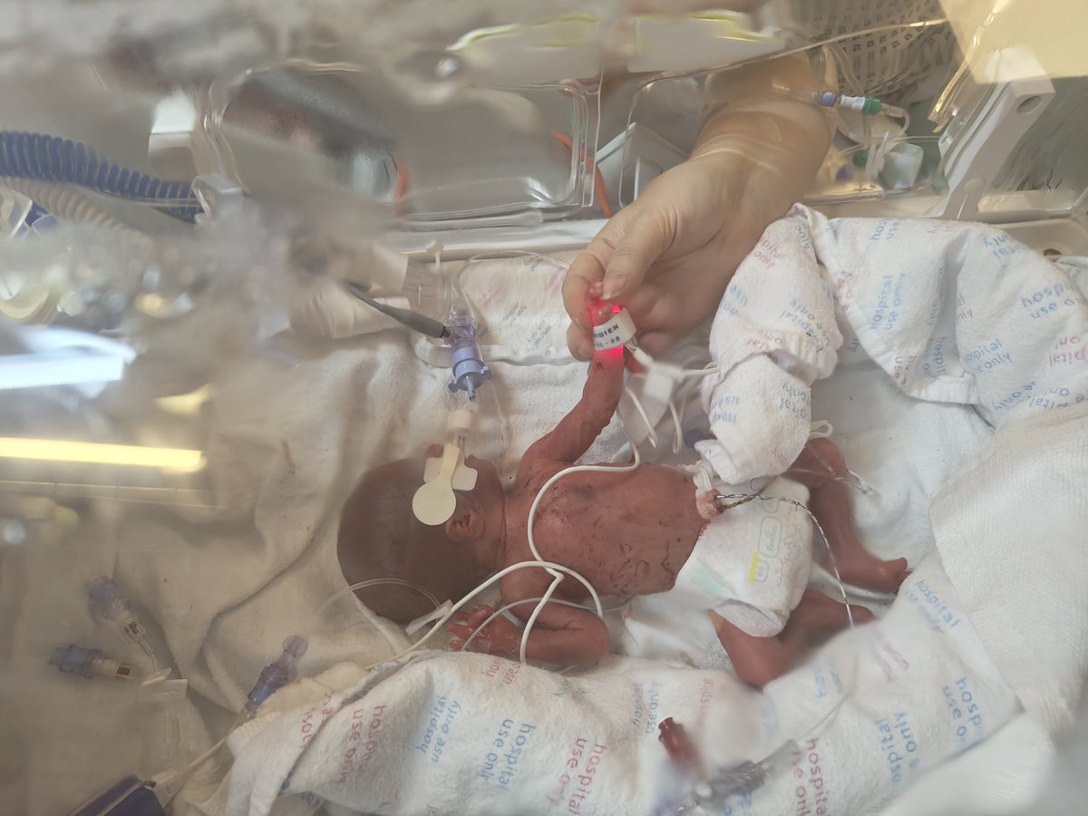 I rarely use X at all,  but just for those that I don't have anywhere else. I kept a bit of a secret! We were pregnant! She's 15 weeks early so has a long way to go,  but Chloe Anne Alcock was born on the 17th weighing just 820 grams. Mum is doing great.