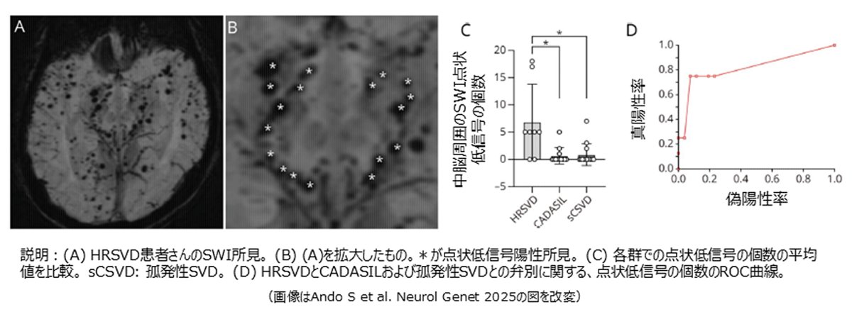 🔬研究成果🔎
脳神経内科学分野の安藤昭一朗助教、小野寺理教授らの研究グループは、HTRA1関連脳小血管病（HTRA1-related Cerebral Small Vessel Disease: HRSVD）の診断に有用な、新しい頭部MRI所見である「Chocolate Chip Sign」を見出しました🧠
bri.niigata-u.ac.jp/research/resul…