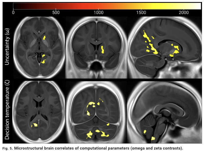Francesca Fardo (@francescafardo) on Twitter photo Excited to share our latest publication, out now in <a href="/ScienceAdvances/">Science Advances</a>: “Thermosensory predictive coding underpins an illusion of pain.” science.org/doi/10.1126/sc…. Read the full thread below for details! Excited to share our latest publication, out now in <a href="/ScienceAdvances/">Science Advances</a>: “Thermosensory predictive coding underpins an illusion of pain.” science.org/doi/10.1126/sc…. Read the full thread below for details!