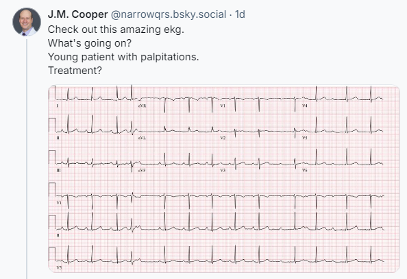 narrowQRS's tweet image. Posting good learning cases over on BIue Sky.
Come on over!  (I&apos;m narrowQRS there too!)