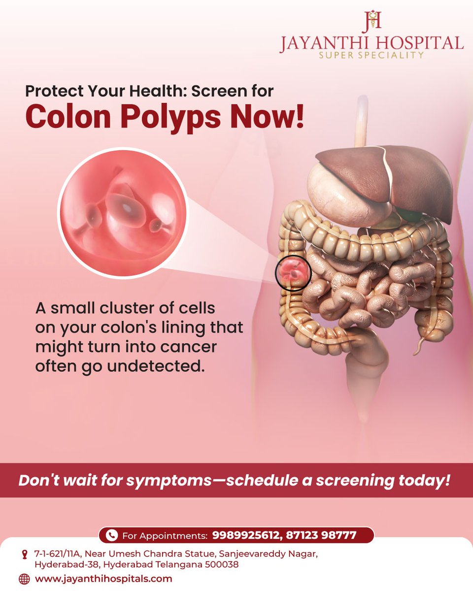 JayanthiHsptls's tweet image. Colon polyps are small growths on the inner lining of the colon that can be benign or precancerous. At Jayanthi Hospitals, we offer different kinds of treatment for Colon Polyps including advanced screening and removal of polyps through colonoscopy.
#ColonHealth #ColonPolyps