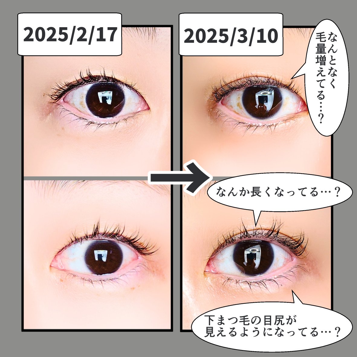 KT7531825366936's tweet photo. #PR soaddict様(@soaddicted_jp)
2025 2/17〜3/10まで塗り続けた報告！全体的に長さが出た？(続↓)
#forcise #ラッシュアディクト #Lashaddict #ラッシュアディクトアドバンス #まつげ美容液 #まつ毛美容液 #アイラッシュ #アイケア #リニューアル #beautypark_shop #monipla #forcise_fan https://t.co/OIGrJ4K2hB