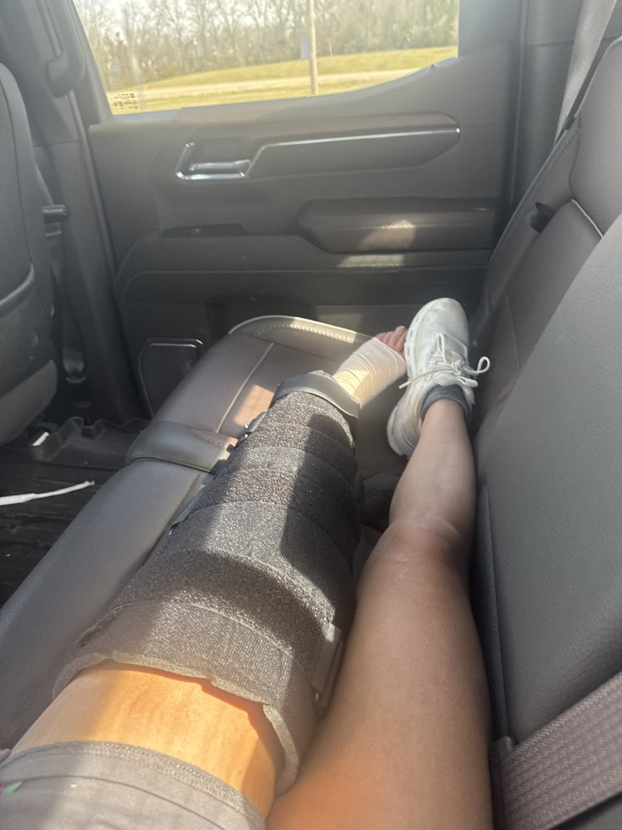 ACL Recovery has been working it! Thank God for the best doctors and surgeons. So far muscle is intact and still able to work out! Praise God! #SecondACLsurgery !