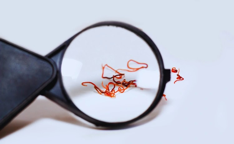 Witness the unseen invaders: masters of survival, rulers of misery, and nature's smallest yet most dangerous parasitic worms.
#Parasite #worm #deadly
Read more here👇
usopman.com/2025/03/most-d…