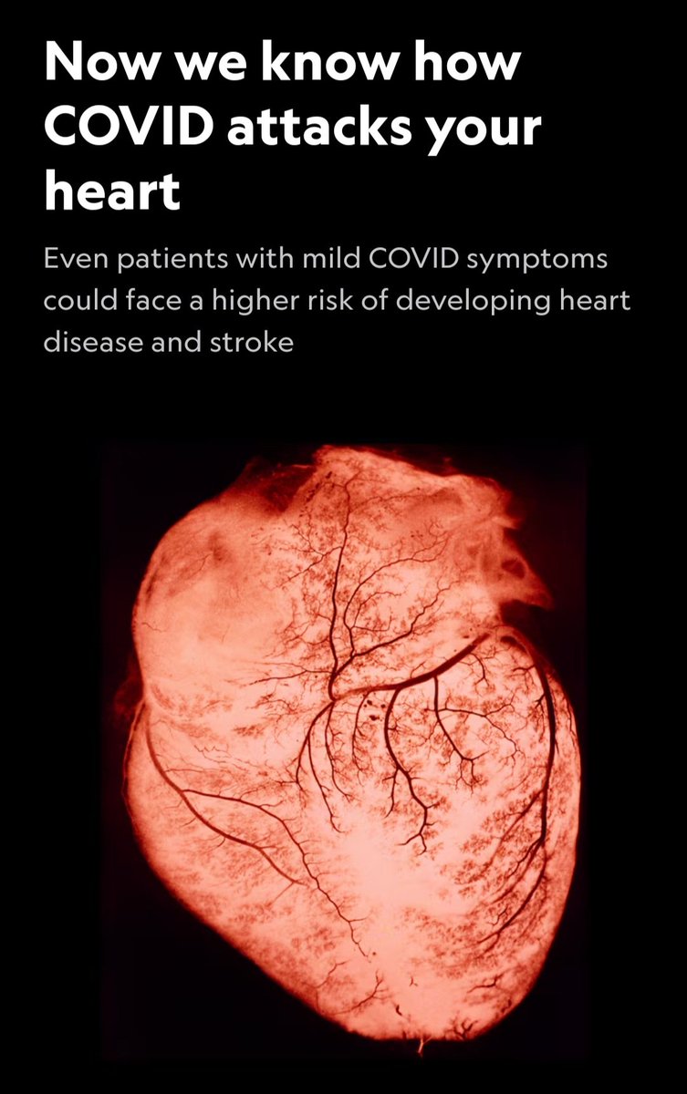 As expected

"The virus can survive and grow inside the cells that form plaque-the buildup of fat-filled cells that narrow and stiffen the arteries,leading to atherosclerosis. If the plaque breaks,it can block blood flow and cause a heart attack or stroke"
nationalgeographic.com/premium/articl…