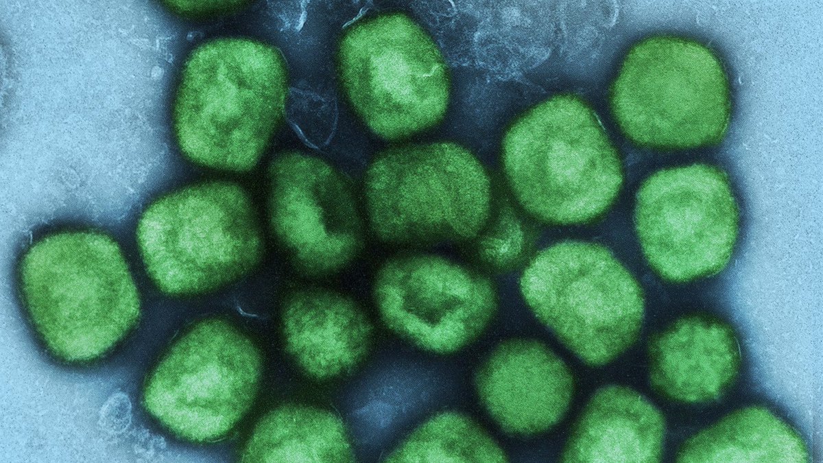 Das #Mpox-Infektionsgeschehen ist in Deutschland gesunken, weltweit gibt es aber weiter Ausbrüche. Eine #CharitéBerlin-Studie liefert nun neue Daten zur Wirksamkeit der Impfung: Bereits eine Dosis wirkt gut – allerdings nicht bei Menschen mit HIV. Mehr: charite.de/service/presse…