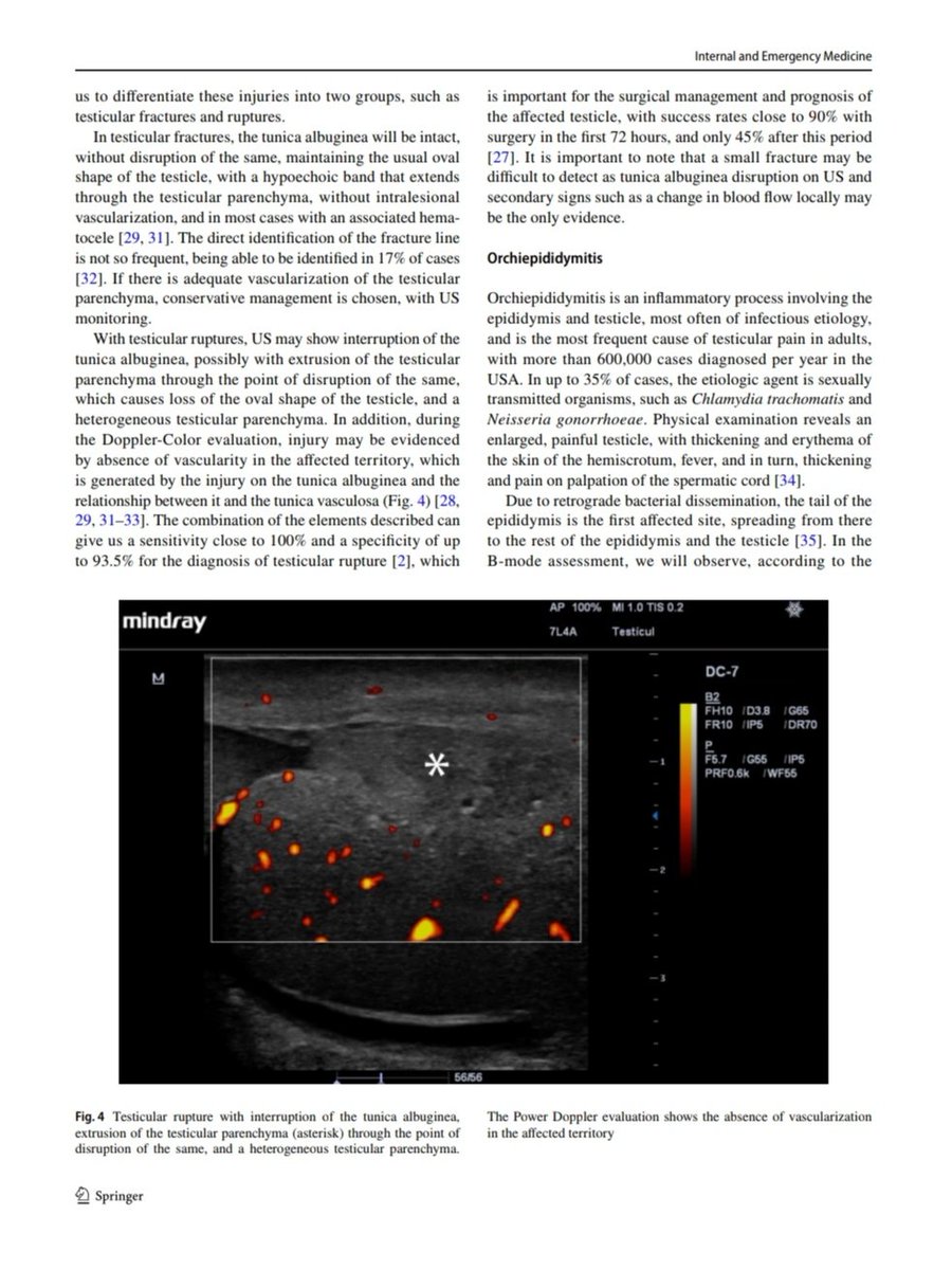 Joaquín Martínez (@jmmr83) on Twitter photo Ultrasonido testicular, de <a href="/zbriote/">José António Briote Mariz</a>
<a href="/NephroP/">NephroPOCUS</a> <a href="/OswaldoRamosN/">Dr. Oswaldo Ramos</a> <a href="/drPowerDoppler/">DrDopplerPoder</a> <a href="/marioalrb84_a/">Dr. tocino</a> <a href="/javiteigell/">Javier Teigell</a> <a href="/y_interna/">Medicina Interna. Lo miro y mañana te digo.</a> <a href="/yaletung/">Yale Tung-Chen</a> <a href="/SonoSamMD/">Samuel García Rubio</a> <a href="/curromir/">Curro Miralles</a> <a href="/ABCDEcografia/">ABCDEcografía</a> <a href="/jpalacinp/">Jose Maria Palacin</a> <a href="/jorgezzb/">Jorge Zegarra</a> <a href="/ignaciomsb/">Ignacio M Sánchez 🇪🇦🇪🇺🇺🇦🎸</a> <a href="/AlvarezHigueras/">Fco. Javier Alvarez Higueras</a> <a href="/mberchid/">M. Solimán Berchíd Debdi</a> <a href="/EcosemfyC/">EcosemFYC</a> <a href="/USPed_Latam/">USPed</a> <a href="/GTEcoSemergen/">Grupo Trabajo Ecografía Semergen #GTEcoSemergen</a> Ultrasonido testicular, de <a href="/zbriote/">José António Briote Mariz</a>
<a href="/NephroP/">NephroPOCUS</a> <a href="/OswaldoRamosN/">Dr. Oswaldo Ramos</a> <a href="/drPowerDoppler/">DrDopplerPoder</a> <a href="/marioalrb84_a/">Dr. tocino</a> <a href="/javiteigell/">Javier Teigell</a> <a href="/y_interna/">Medicina Interna. Lo miro y mañana te digo.</a> <a href="/yaletung/">Yale Tung-Chen</a> <a href="/SonoSamMD/">Samuel García Rubio</a> <a href="/curromir/">Curro Miralles</a> <a href="/ABCDEcografia/">ABCDEcografía</a> <a href="/jpalacinp/">Jose Maria Palacin</a> <a href="/jorgezzb/">Jorge Zegarra</a> <a href="/ignaciomsb/">Ignacio M Sánchez 🇪🇦🇪🇺🇺🇦🎸</a> <a href="/AlvarezHigueras/">Fco. Javier Alvarez Higueras</a> <a href="/mberchid/">M. Solimán Berchíd Debdi</a> <a href="/EcosemfyC/">EcosemFYC</a> <a href="/USPed_Latam/">USPed</a> <a href="/GTEcoSemergen/">Grupo Trabajo Ecografía Semergen #GTEcoSemergen</a>