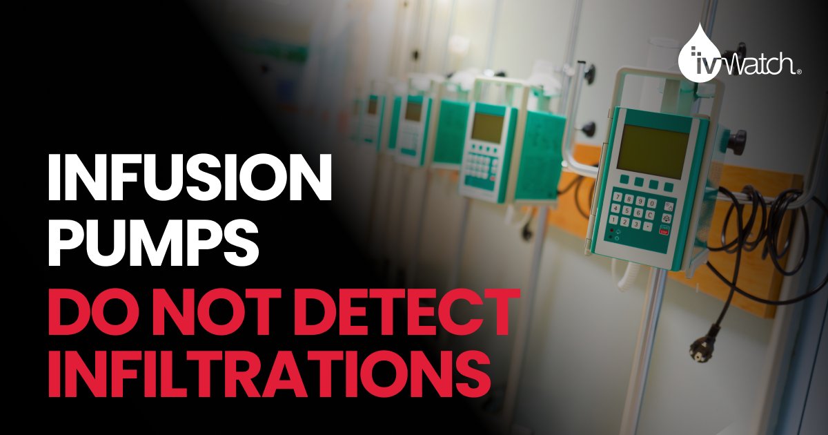 𝗪𝗔𝗥𝗡𝗜𝗡𝗚: Infusion pumps are designed to deliver fluids, but they do not detect infiltrations. ivWatch is the only FDA-cleared and CE-Marked device able to alert clinicians at the earliest signs of infiltration and extravasation events.
 
It’s time to step up IV monitoring