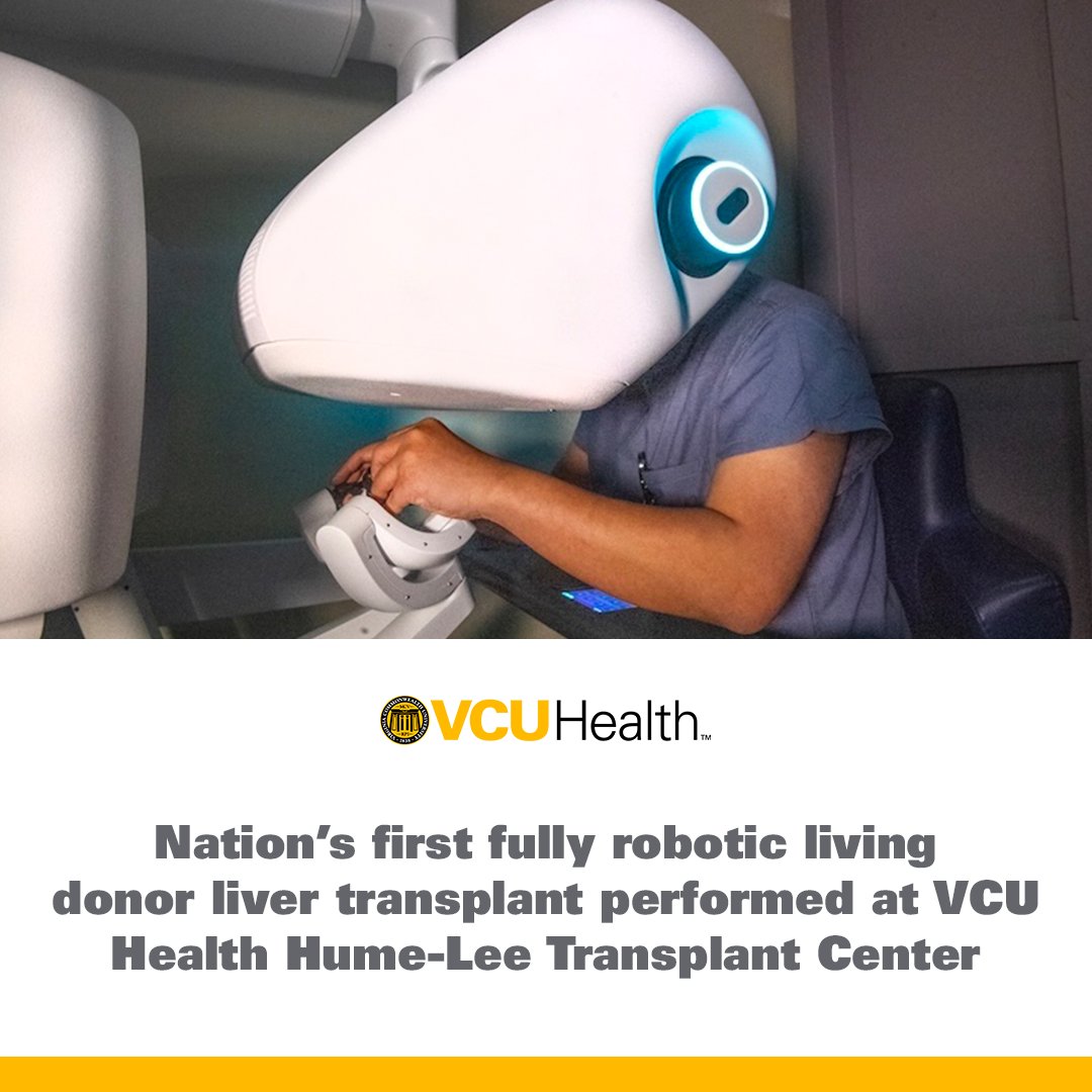 History made! Hume-Lee is the first in the U.S. to perform a fully robotic living donor liver transplant—offering patients a safer, less invasive option. Read more 🔗: bit.ly/4iG3ELL 
#TransplantInnovation #RoboticSurgery #LivingDonation #LiverTwitter