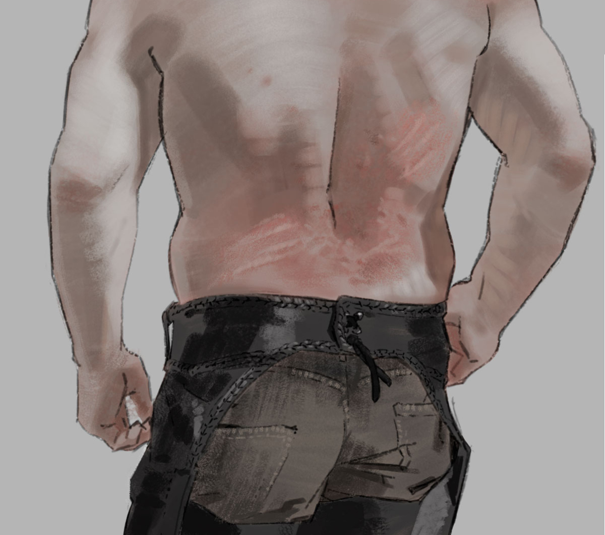 oakn ๐บ๐ฆ (comms open) (@oak_andr) on Twitter photo acne + scratch marks acne + scratch marks
