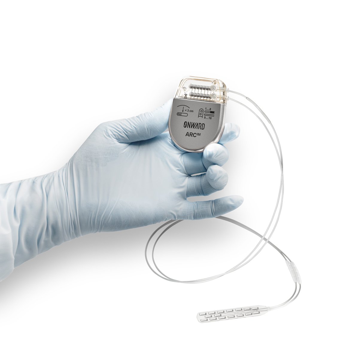 onwdempowered's tweet image. 🚀 Milestone Alert from ONWARD Medical! 🚀
We're thrilled to announce the successful first human implant of our investigational ARC-IM Lumbar Lead! This procedure, performed last week by neurosurgeon, Dr. @Jocelyne_Bloch, at Lausanne University Hospital (CHUV) in Switzerland,…