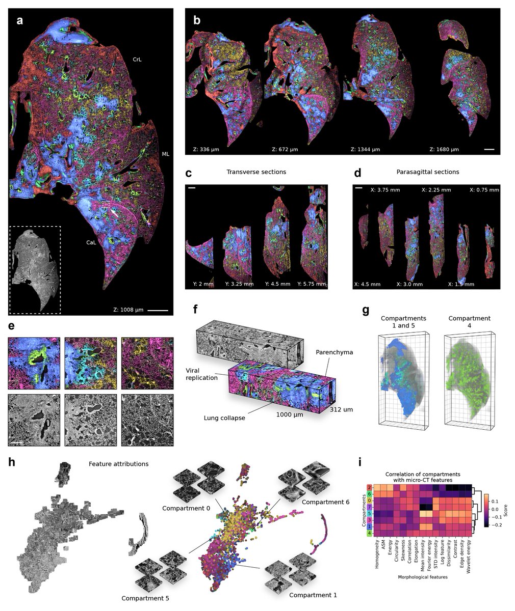 Take a look inside a SARS-CoV-2-infected mouse lung with X-Pression! Our 3D reconstructions reveal changes in gene expression programs across the entire organ, leveraging ST and micro-CT. Check out the details in our preprint: biorxiv.org/content/10.110… #SpatialTranscriptomics