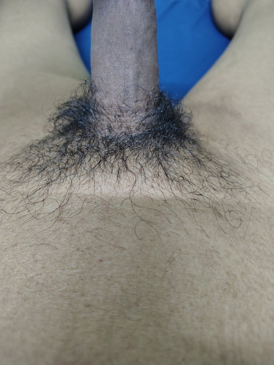 Horney 🍆💦#femboy #shemale #trans #ladyboy #gay #gaybottom #Bottoms #indiangay #twink #gaytwink #slut #transslut #gayteen #gayhole #bussy #gayass #dick #fuck #boypussy #bubblebutt #whiteboi #bigdick #crossdresser #cd #hung #gayass #cock #gayfuck #gaynsfw #pussyboy